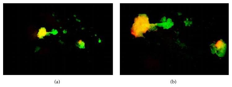 https://cdn.ncbi.nlm.nih.gov/pmc/blobs/3be1/4609365/d3220ea8866b/BMRI2015-576532.009.jpg