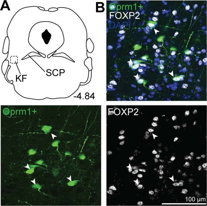 https://cdn.ncbi.nlm.nih.gov/pmc/blobs/3be4/10317500/66b2a7462186/elife-81119-fig6.jpg