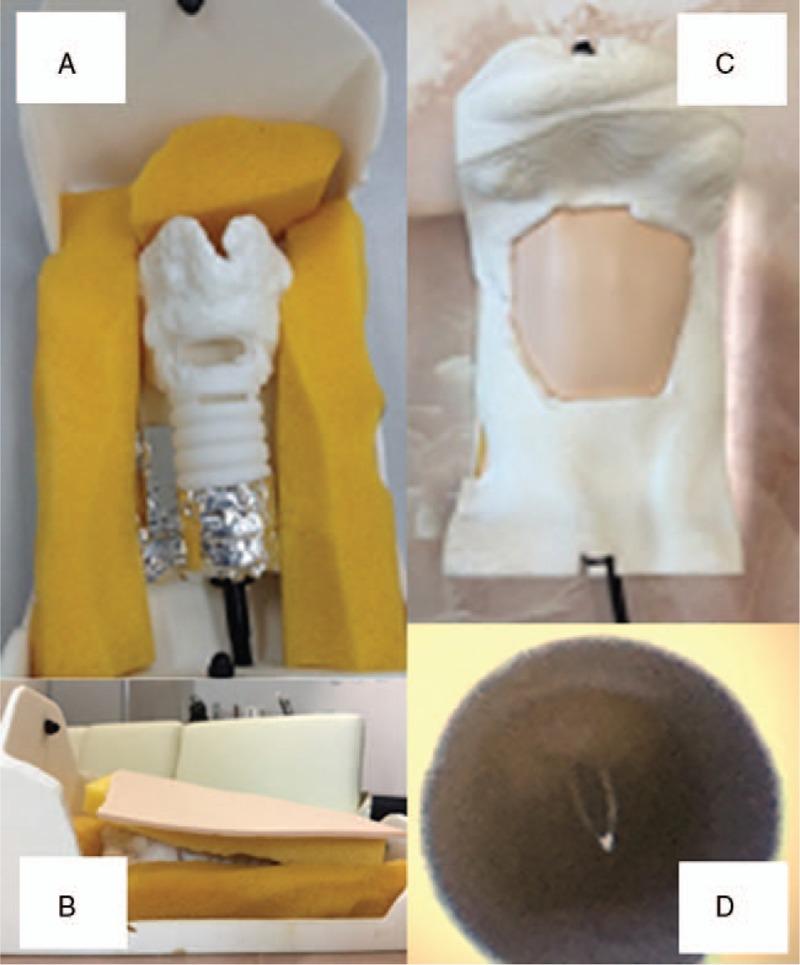 https://cdn.ncbi.nlm.nih.gov/pmc/blobs/3bfc/6408010/53bb1735b74f/medi-98-e14665-g001.jpg