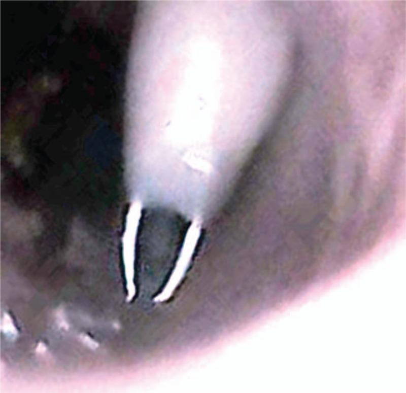 https://cdn.ncbi.nlm.nih.gov/pmc/blobs/3bfc/6408010/ea6b0f6052d9/medi-98-e14665-g005.jpg