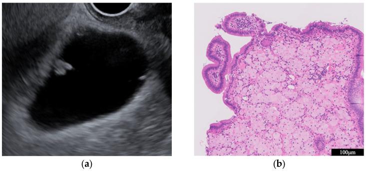 https://cdn.ncbi.nlm.nih.gov/pmc/blobs/3bfe/10887964/08fa8cbec6ac/diagnostics-14-00374-g005.jpg