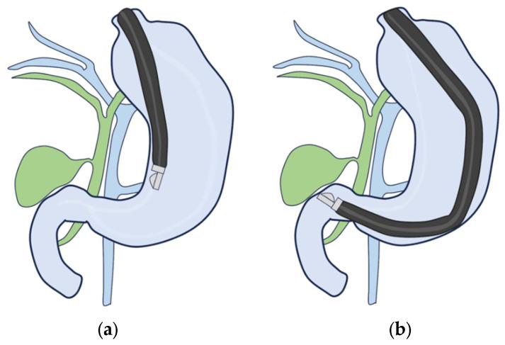 https://cdn.ncbi.nlm.nih.gov/pmc/blobs/3bfe/10887964/5d9a07b3c94a/diagnostics-14-00374-g008.jpg