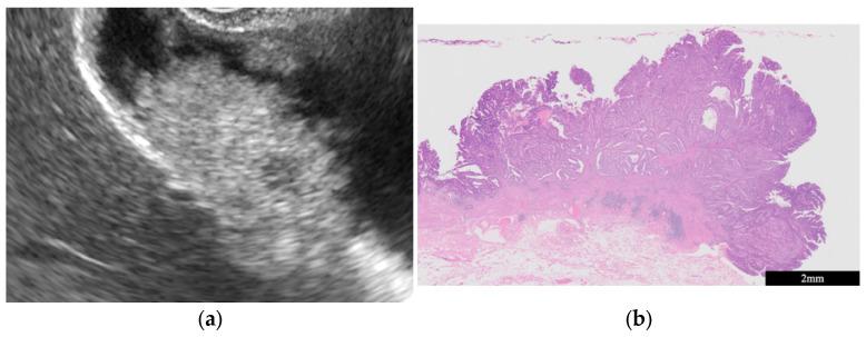 https://cdn.ncbi.nlm.nih.gov/pmc/blobs/3bfe/10887964/65add8e281f1/diagnostics-14-00374-g006.jpg