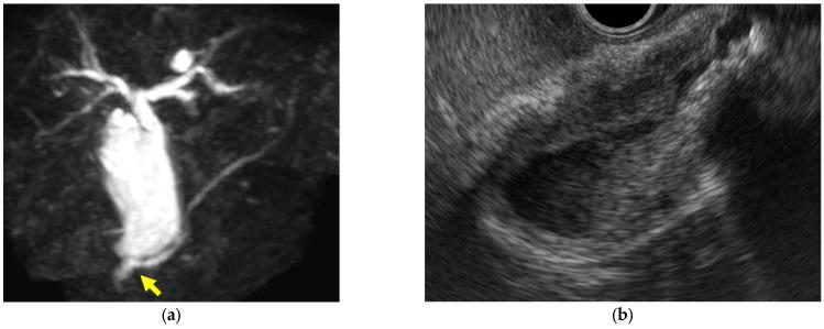 https://cdn.ncbi.nlm.nih.gov/pmc/blobs/3bfe/10887964/a04f0039f076/diagnostics-14-00374-g004.jpg