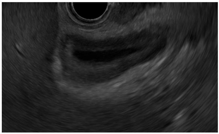 https://cdn.ncbi.nlm.nih.gov/pmc/blobs/3bfe/10887964/d2accfcf2996/diagnostics-14-00374-g003.jpg