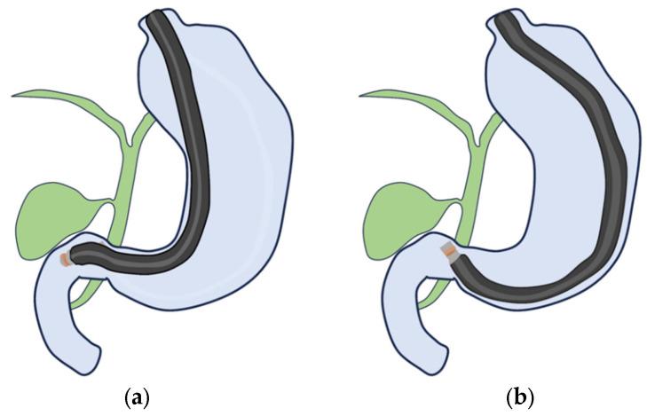 https://cdn.ncbi.nlm.nih.gov/pmc/blobs/3bfe/10887964/df2210c8ad17/diagnostics-14-00374-g007.jpg