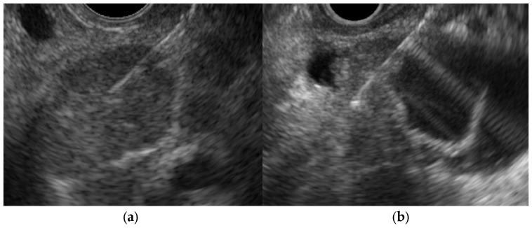 https://cdn.ncbi.nlm.nih.gov/pmc/blobs/3bfe/10887964/ec1758c28530/diagnostics-14-00374-g009.jpg