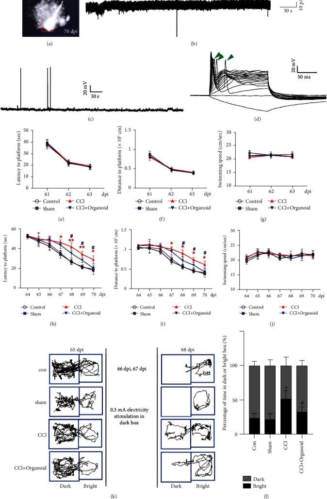 https://cdn.ncbi.nlm.nih.gov/pmc/blobs/3c01/8629662/97c036ff3eb4/OMCL2021-6338722.005.jpg