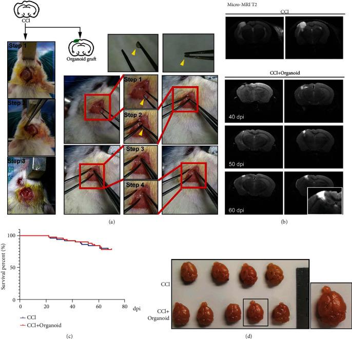 https://cdn.ncbi.nlm.nih.gov/pmc/blobs/3c01/8629662/9d0c2d403a90/OMCL2021-6338722.002.jpg