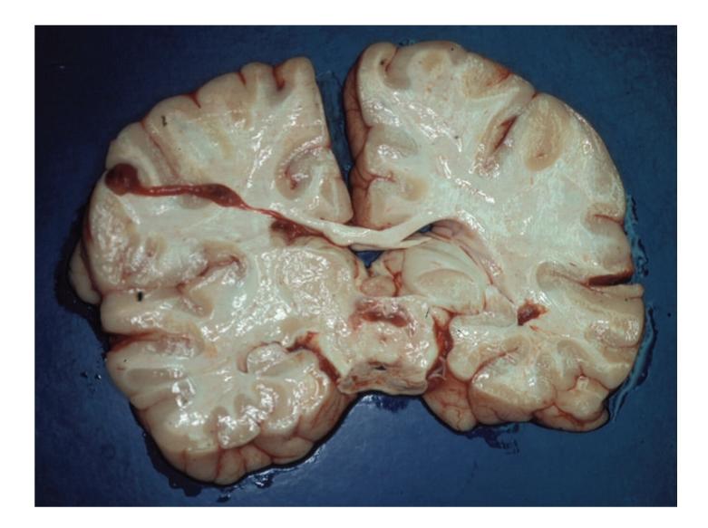 https://cdn.ncbi.nlm.nih.gov/pmc/blobs/3c04/2892709/2afc6a3a9c12/CRM2010-986302.001.jpg