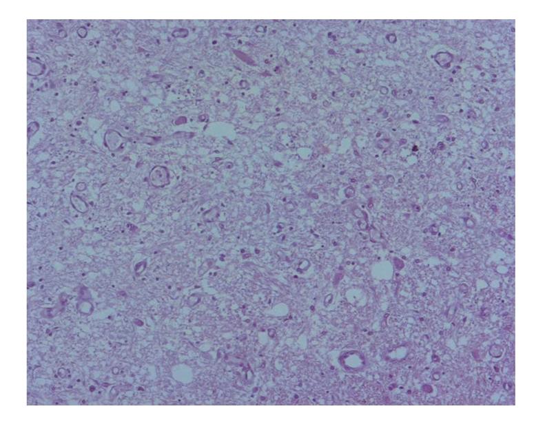 https://cdn.ncbi.nlm.nih.gov/pmc/blobs/3c04/2892709/74a719681444/CRM2010-986302.003.jpg