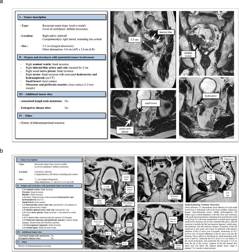https://cdn.ncbi.nlm.nih.gov/pmc/blobs/3c05/12021987/b880a6fb8909/330_2024_10940_Fig6_HTML.jpg