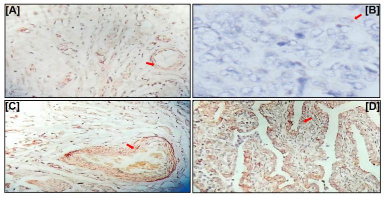 https://cdn.ncbi.nlm.nih.gov/pmc/blobs/3c08/10532047/b707c5d29be0/ijms-24-14239-g002.jpg