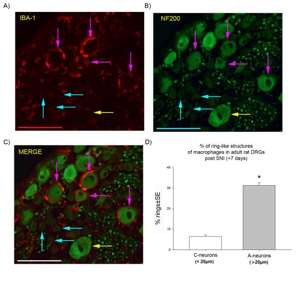 https://cdn.ncbi.nlm.nih.gov/pmc/blobs/3c08/2799401/3346392fea45/1744-8069-5-70-4.jpg