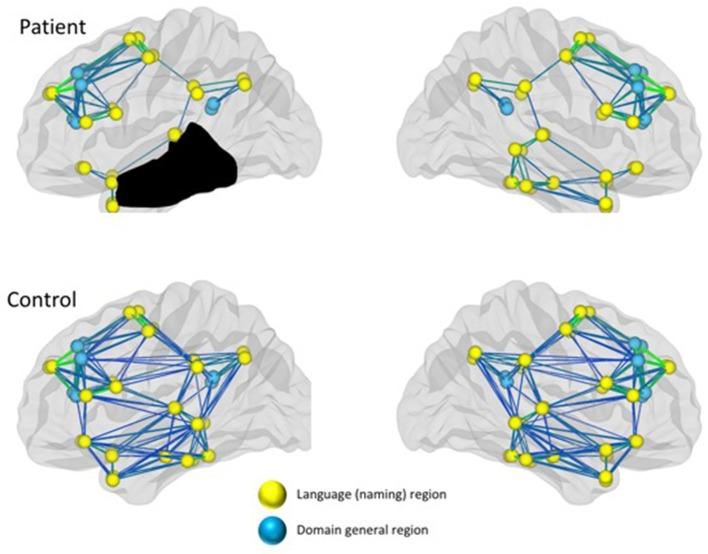 https://cdn.ncbi.nlm.nih.gov/pmc/blobs/3c09/6454116/d4ca092c32e4/fneur-10-00295-g0002.jpg