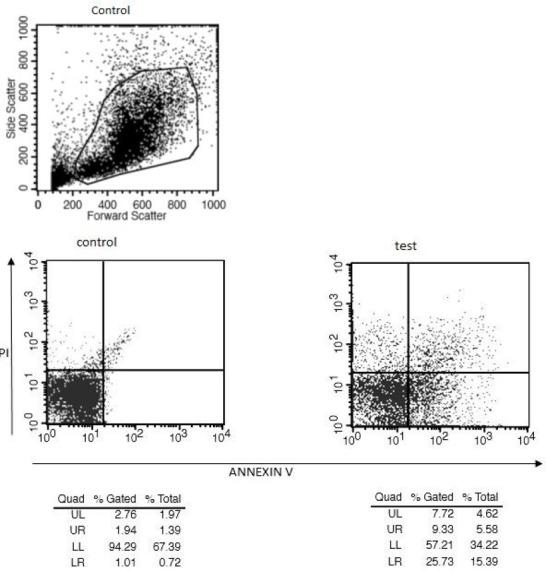 https://cdn.ncbi.nlm.nih.gov/pmc/blobs/3c15/5412222/74f093757921/AJTCAM-14-167-g006.jpg