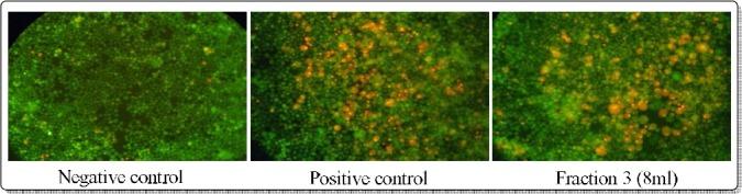 https://cdn.ncbi.nlm.nih.gov/pmc/blobs/3c15/5412222/bfe15b155ab8/AJTCAM-14-167-g005.jpg