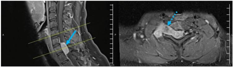 https://cdn.ncbi.nlm.nih.gov/pmc/blobs/3c16/10464919/23338c848b5d/cureus-0015-00000042687-i01.jpg