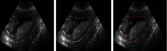 https://cdn.ncbi.nlm.nih.gov/pmc/blobs/3c1a/8648457/8ef6be4da3e4/JHE2021-9886521.007.jpg