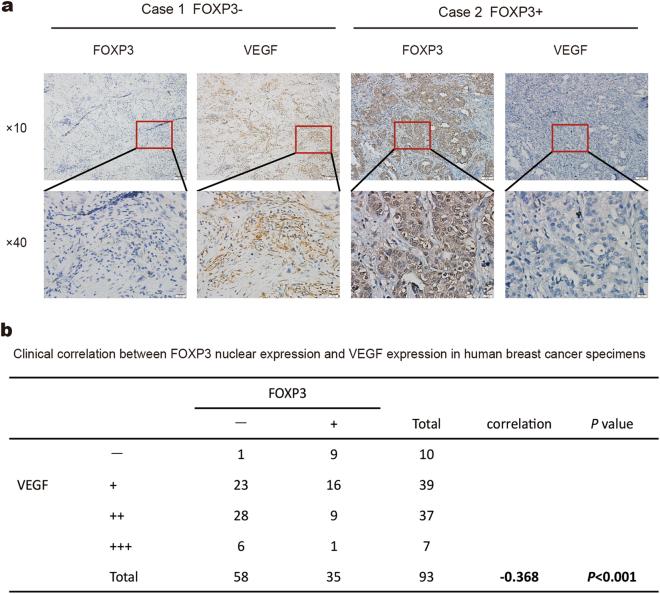 https://cdn.ncbi.nlm.nih.gov/pmc/blobs/3c23/6030162/00e34c3a707d/41419_2018_790_Fig6_HTML.jpg