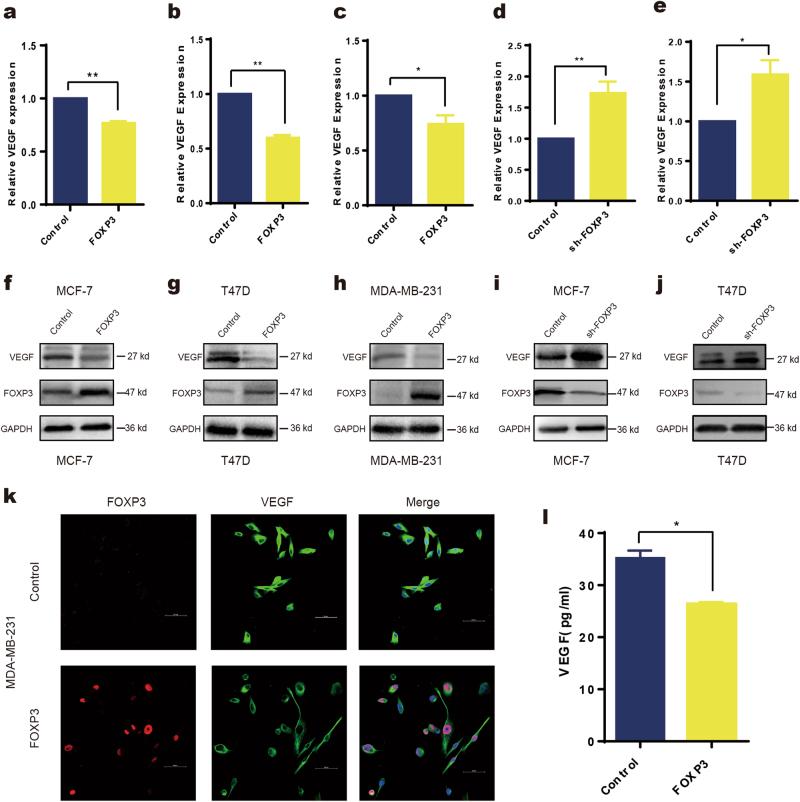 https://cdn.ncbi.nlm.nih.gov/pmc/blobs/3c23/6030162/345171ce498b/41419_2018_790_Fig4_HTML.jpg