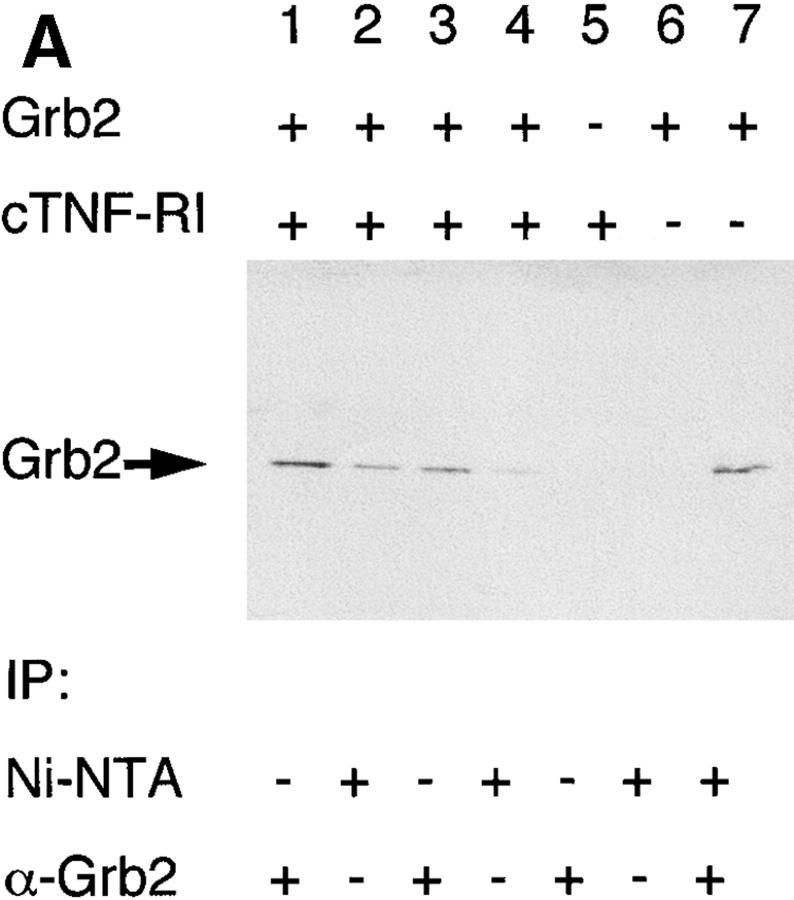 https://cdn.ncbi.nlm.nih.gov/pmc/blobs/3c26/2193078/c5ad22c3adcc/JEM982169.f1a.jpg