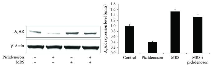 https://cdn.ncbi.nlm.nih.gov/pmc/blobs/3c28/5976987/06a44ed361f9/JIR2018-2310970.003.jpg