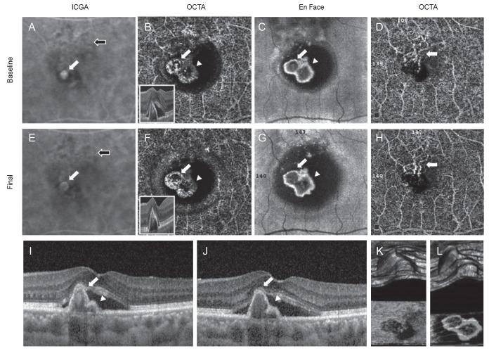 https://cdn.ncbi.nlm.nih.gov/pmc/blobs/3c29/6372389/6a3ccb3ff047/kjo-33-54-g004.jpg