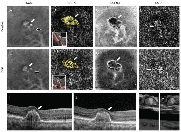 https://cdn.ncbi.nlm.nih.gov/pmc/blobs/3c29/6372389/74bcd22921fd/kjo-33-54-g002.jpg