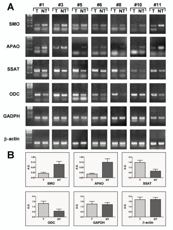 https://cdn.ncbi.nlm.nih.gov/pmc/blobs/3c35/3027604/9614537785d4/1471-2407-10-555-1.jpg