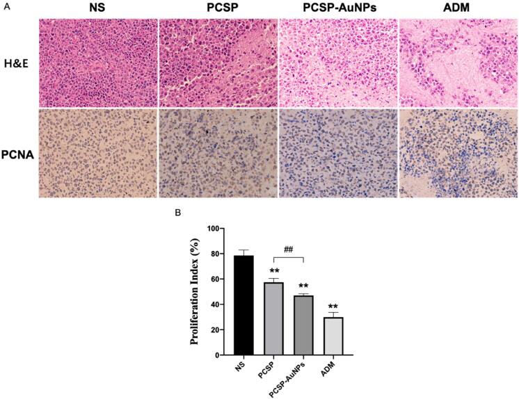 https://cdn.ncbi.nlm.nih.gov/pmc/blobs/3c35/9246265/81195f88a440/IDRD_A_2092238_F0007_C.jpg