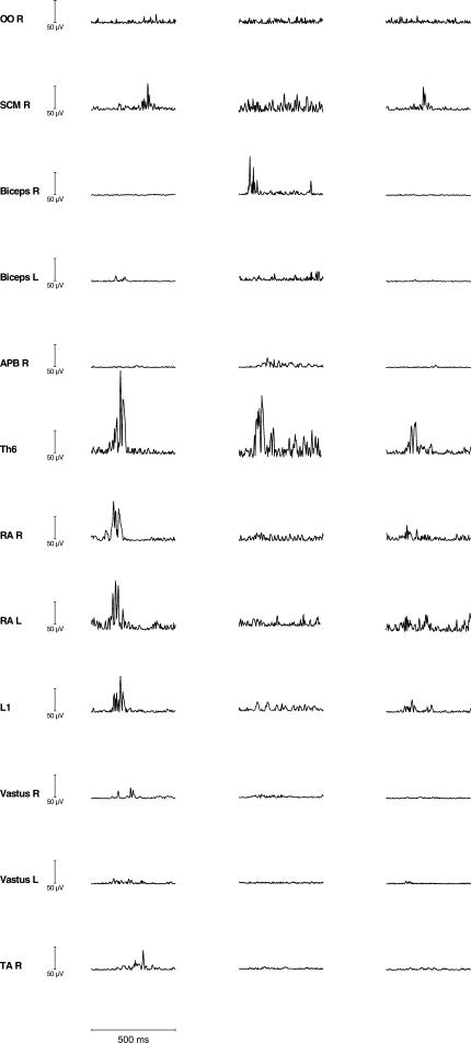 https://cdn.ncbi.nlm.nih.gov/pmc/blobs/3c46/2910307/b49bebb17fab/415_2010_5531_Fig2_HTML.jpg