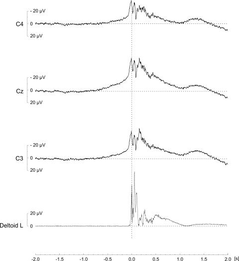 https://cdn.ncbi.nlm.nih.gov/pmc/blobs/3c46/2910307/ebd968e25ec6/415_2010_5531_Fig1_HTML.jpg