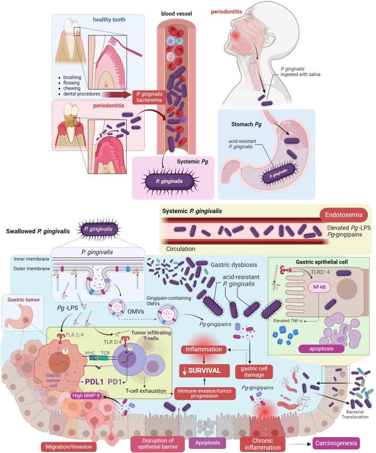 https://cdn.ncbi.nlm.nih.gov/pmc/blobs/3c4a/11130407/a00f90e2cac9/fonc-14-1403089-g002.jpg