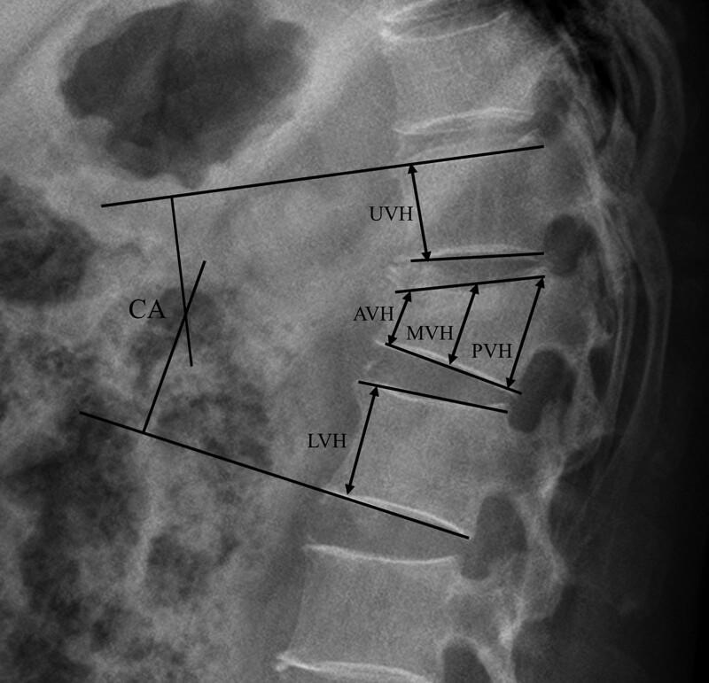 https://cdn.ncbi.nlm.nih.gov/pmc/blobs/3c4b/9371513/78eeb163c38b/medi-101-e29983-g001.jpg