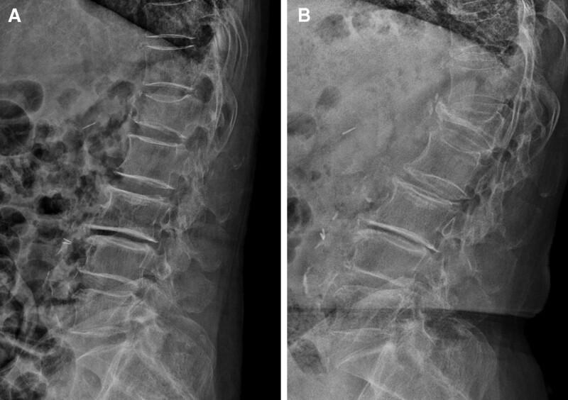 https://cdn.ncbi.nlm.nih.gov/pmc/blobs/3c4b/9371513/960f5be6d740/medi-101-e29983-g003.jpg
