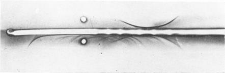 https://cdn.ncbi.nlm.nih.gov/pmc/blobs/3c51/2020333/81eb11214d48/archdisch01555-0098-a.jpg