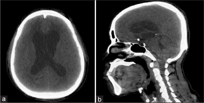 https://cdn.ncbi.nlm.nih.gov/pmc/blobs/3c59/10783673/be0b61aba46b/SNI-14-447-g001.jpg