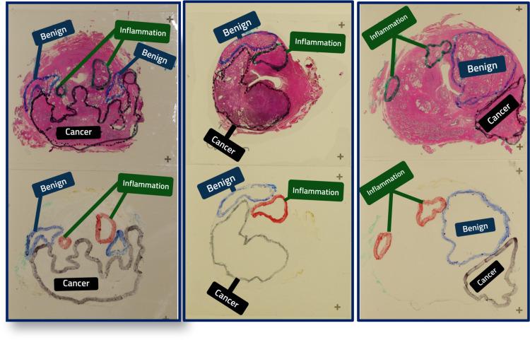 https://cdn.ncbi.nlm.nih.gov/pmc/blobs/3c5b/8492166/131591e94889/cureus-0013-00000017742-i01.jpg