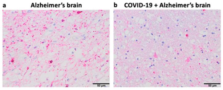 https://cdn.ncbi.nlm.nih.gov/pmc/blobs/3c66/10890058/fe202fe66f57/life-14-00279-g004.jpg