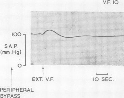 https://cdn.ncbi.nlm.nih.gov/pmc/blobs/3c71/1019057/3c7c107bcd76/thorax00088-0093-a.jpg