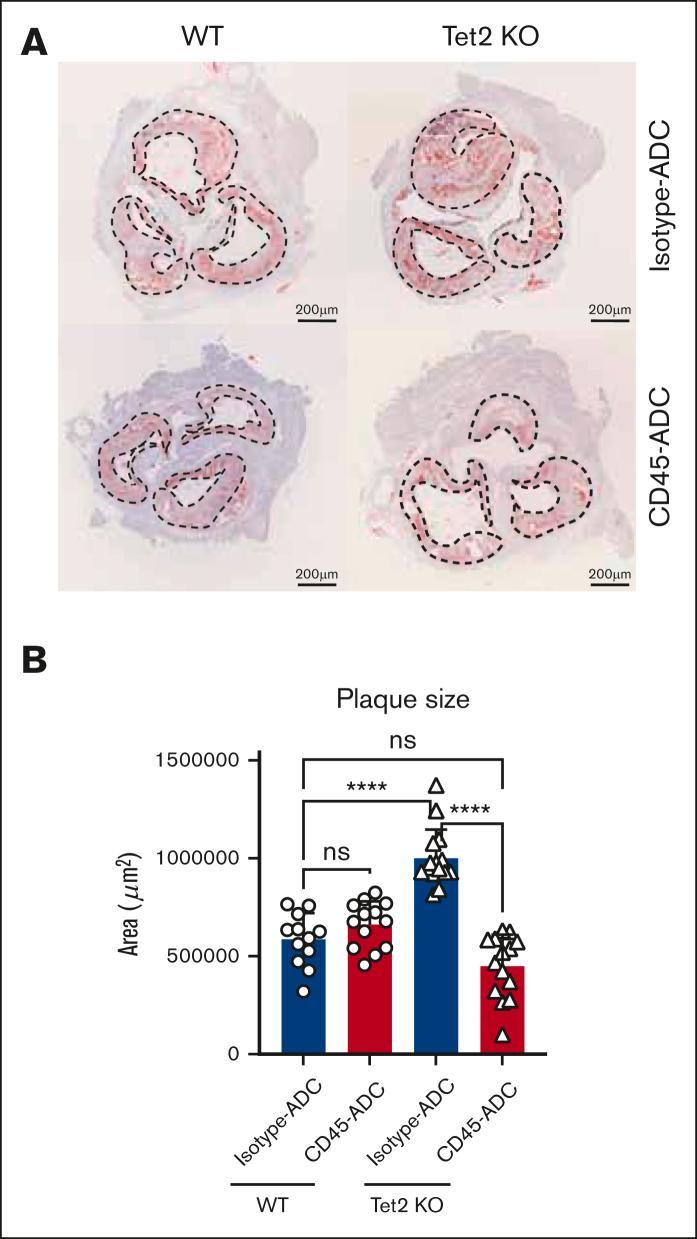 https://cdn.ncbi.nlm.nih.gov/pmc/blobs/3c76/10690556/56e78bcf3cd6/BLOODA_ADV-2023-010561-gr5.jpg