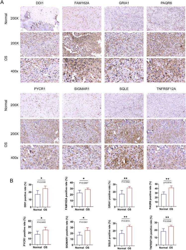 https://cdn.ncbi.nlm.nih.gov/pmc/blobs/3c77/12087067/360e4f0d339f/13018_2025_5716_Fig8_HTML.jpg