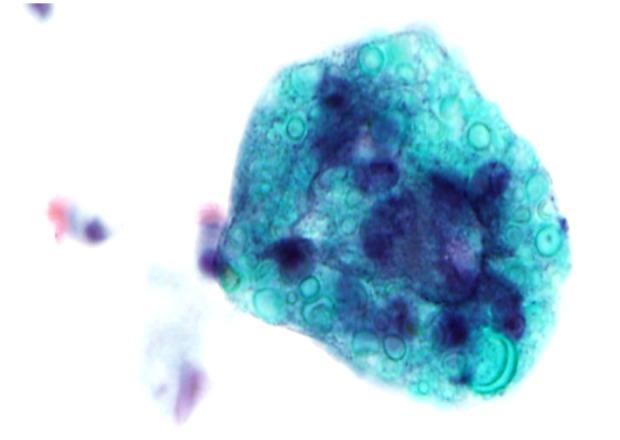 https://cdn.ncbi.nlm.nih.gov/pmc/blobs/3c79/6977631/7b5ff87f48d7/amjcaserep-21-e919267-g002.jpg
