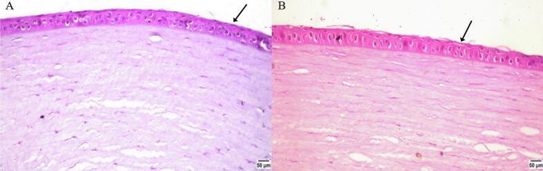 https://cdn.ncbi.nlm.nih.gov/pmc/blobs/3c7b/12023791/513a01452d9a/gr4.jpg