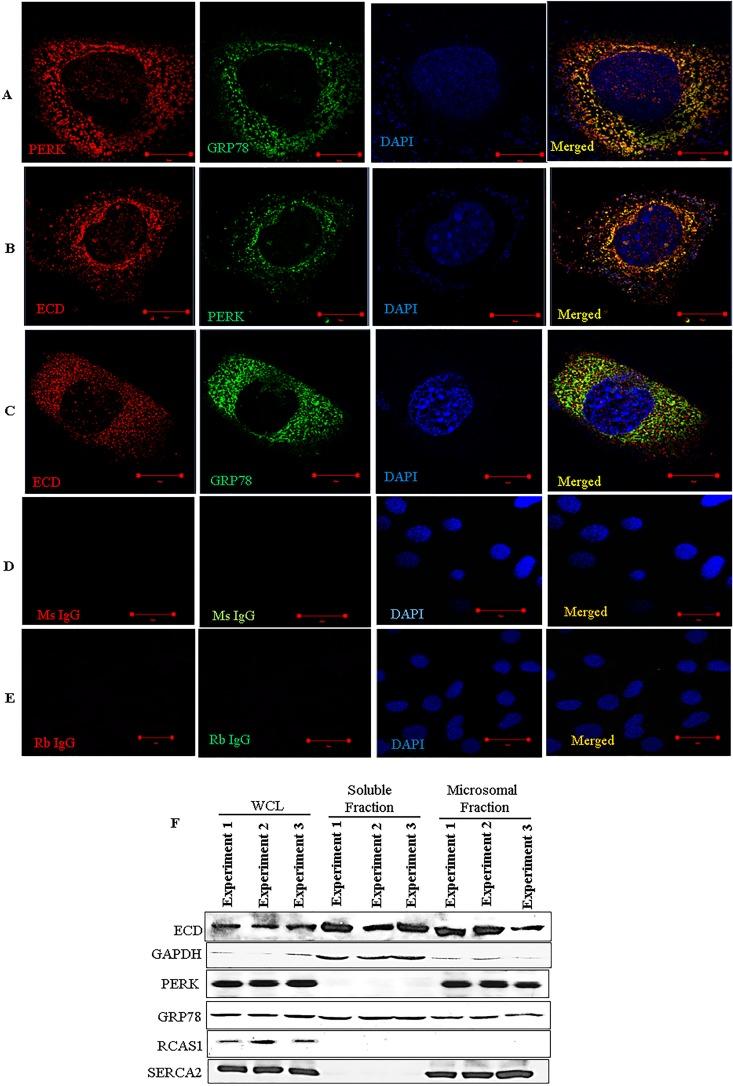 https://cdn.ncbi.nlm.nih.gov/pmc/blobs/3c7d/5574048/b95c7f64f6a5/zmb999101589002a.jpg