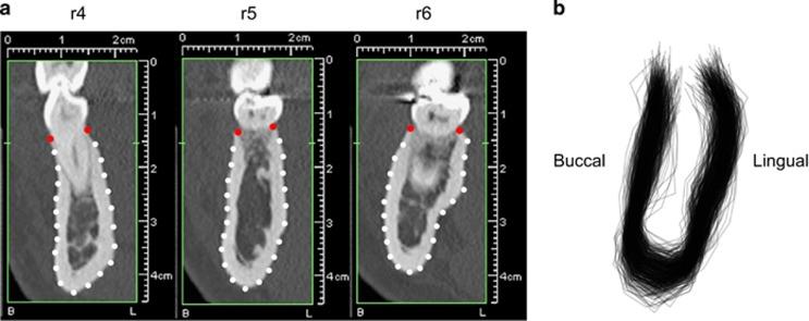 https://cdn.ncbi.nlm.nih.gov/pmc/blobs/3c7e/5168418/7c17f8b9c557/ijos201641f1.jpg