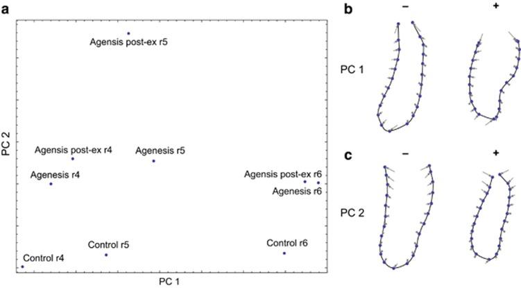 https://cdn.ncbi.nlm.nih.gov/pmc/blobs/3c7e/5168418/feafb792c8d2/ijos201641f5.jpg