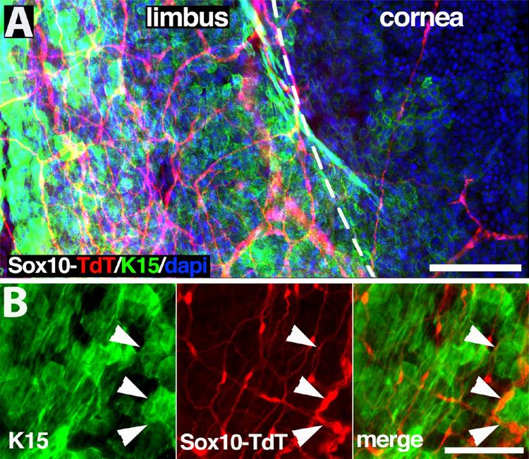 https://cdn.ncbi.nlm.nih.gov/pmc/blobs/3c80/10103722/a79a17671879/iovs-64-4-7-f002.jpg