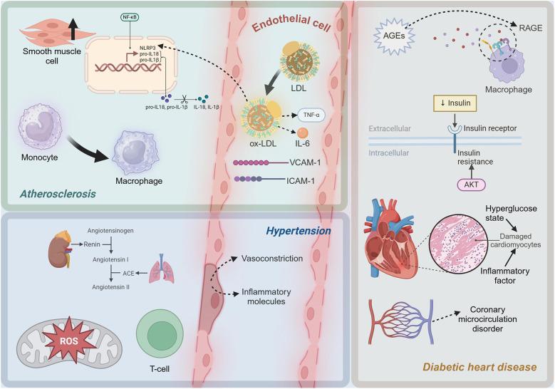 https://cdn.ncbi.nlm.nih.gov/pmc/blobs/3c83/11772298/02a676c9512d/fcvm-11-1529903-g001.jpg